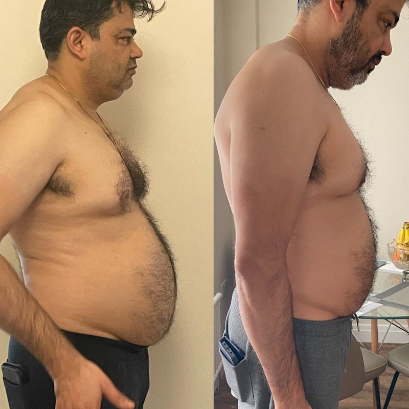 Smiti transformation